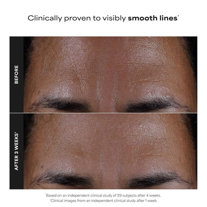 Paula's Choice SKIN PERFECTING 2% BHA Liquid Exfoliant with Salicylic Acid, Facial Polish for Pores, Wrinkles & Fine Lines, Suitable for Blackhead-Prone Skin, Fragrance-Free